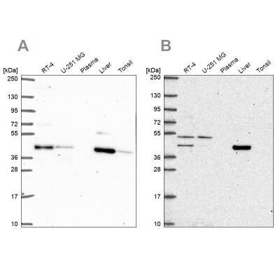 Western Blot: PHKG2 Antibody [NBP2-55815]