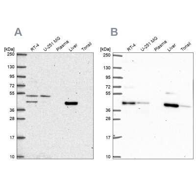 Western Blot: PHKG2 Antibody [NBP2-56609]