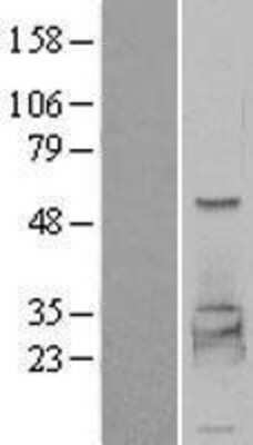 Western Blot: PHKG2 Overexpression Lysate [NBL1-14366]