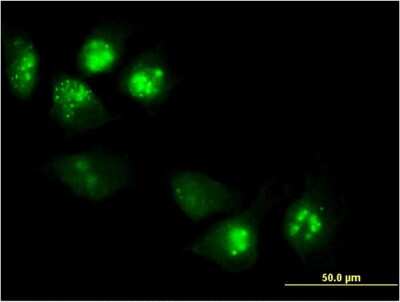 Immunocytochemistry/ Immunofluorescence: PHLDA1 Antibody (3A5) [H00022822-M08]