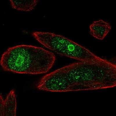 Immunocytochemistry/ Immunofluorescence: PHLDA1 Antibody [NBP2-56404]