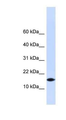 Western Blot: PHLDA3 Antibody [NBP1-56772]