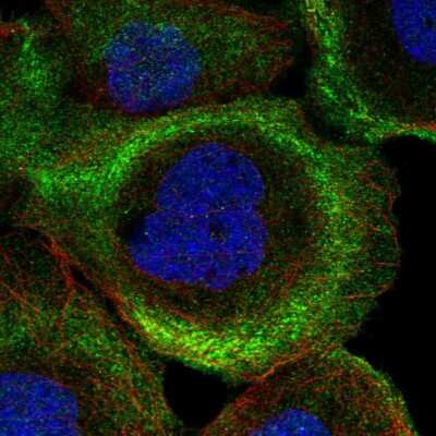 Immunocytochemistry/ Immunofluorescence: PHLDB2 Antibody [NBP2-38238]