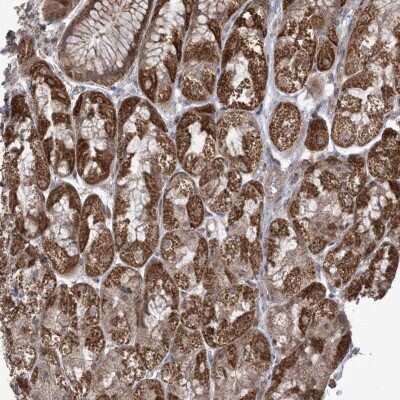 Immunohistochemistry-Paraffin: PHLDB2 Antibody [NBP2-38238]