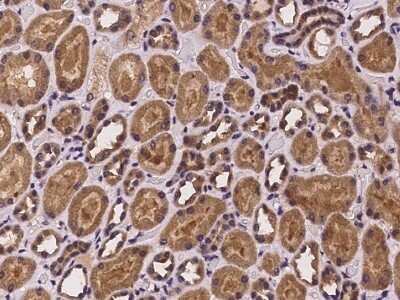 Immunohistochemistry-Paraffin: PHLDB2 Antibody [NBP2-97972]