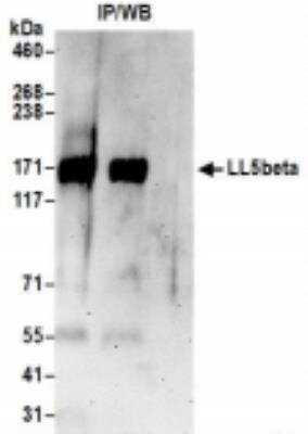 Immunoprecipitation: PHLDB2 Antibody [NBP2-36546]