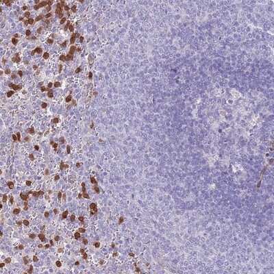 Immunohistochemistry-Paraffin: PHLPP2 Antibody [NBP2-13757]