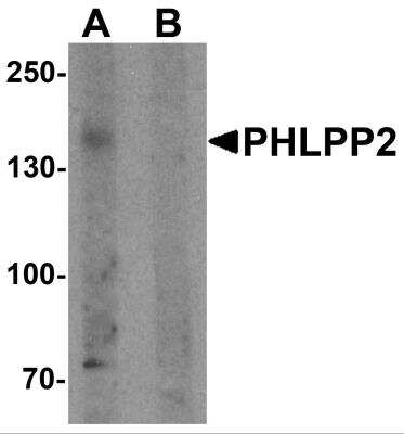 Western Blot: PHLPP2 AntibodyBSA Free [NBP2-81874]