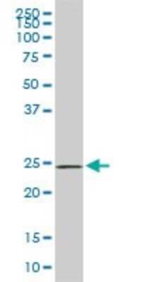 Western Blot: PHOSPHO1 Antibody (4B2) [H00162466-M04]