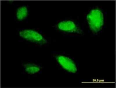 Immunocytochemistry/ Immunofluorescence: PHOX2A Antibody (4F6) [H00000401-M01]