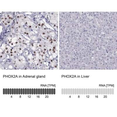 Immunohistochemistry-Paraffin: PHOX2A Antibody [NBP2-62721]