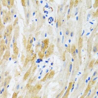 Immunohistochemistry-Paraffin: PHPT1 Antibody - BSA Free [NBP2-94440]