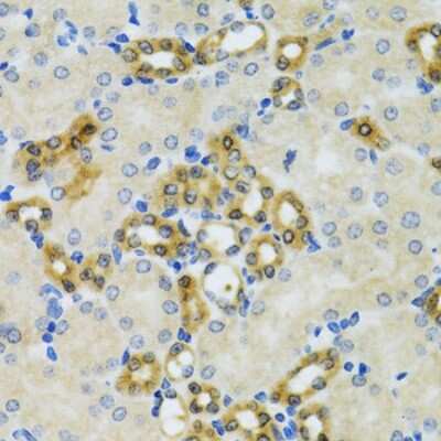 Immunohistochemistry-Paraffin: PHPT1 Antibody - BSA Free [NBP2-94440]