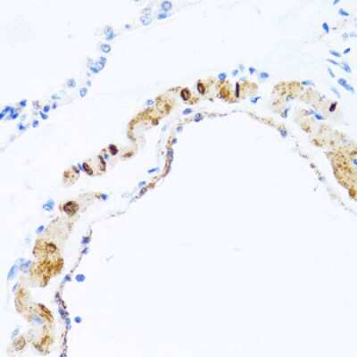 Immunohistochemistry-Paraffin: PHPT1 Antibody - BSA Free [NBP2-94440]