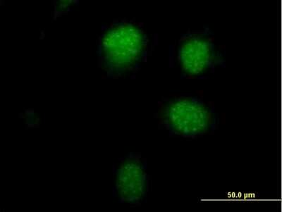 Immunocytochemistry/ Immunofluorescence: PHTF1 Antibody [H00010745-B01P]