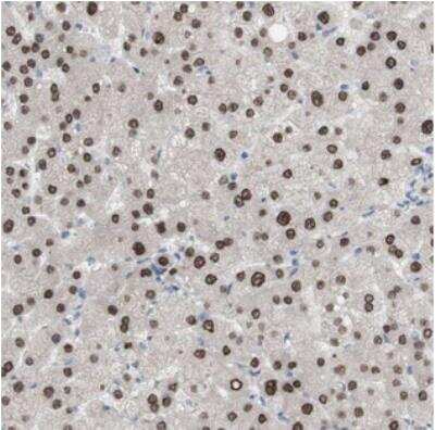 Immunohistochemistry: PHTF2 Antibody [NBP2-30990]