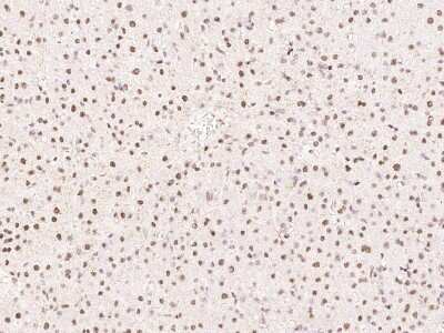 Immunohistochemistry-Paraffin: PHTF2 Antibody [NBP2-97689]