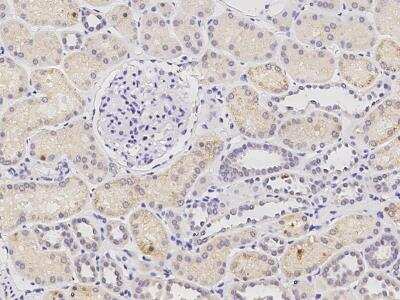 Immunohistochemistry-Paraffin: PHYH Antibody (03) [NBP3-06164]