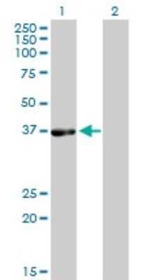 Western Blot: PHYH Antibody (1F2-5B9) [H00005264-M01]