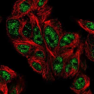 Immunocytochemistry/ Immunofluorescence: PHYHD1 Antibody [NBP1-81187]