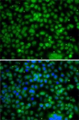 Immunocytochemistry/ Immunofluorescence: PHYHD1 Antibody - BSA Free [NBP2-93015]