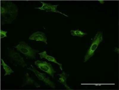 Immunocytochemistry/ Immunofluorescence: PI 3-Kinase C2 beta Antibody (1H4) [H00005287-M06]