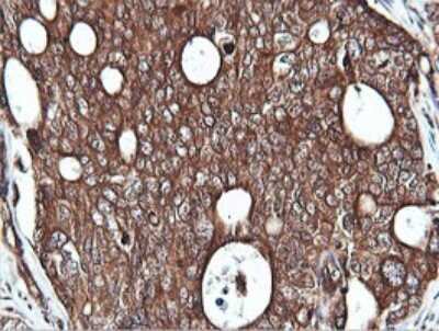 Immunohistochemistry: PI 3-Kinase C2 beta Antibody (OTI3B1) [NBP2-46402]