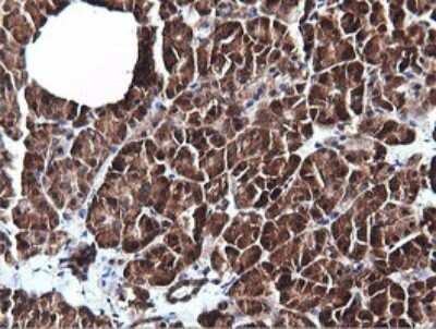 Immunohistochemistry: PI 3-Kinase C2 beta Antibody (OTI3B1) [NBP2-46402]