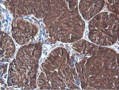 Immunohistochemistry: PI 3-Kinase C2 beta Antibody (OTI3B1) [NBP2-46402]