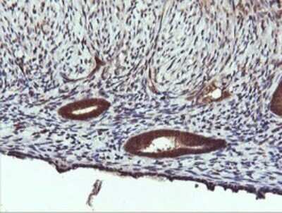 Immunohistochemistry: PI 3-Kinase C2 beta Antibody (OTI3B1) [NBP2-46402]