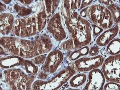 Immunohistochemistry: PI 3-Kinase C2 beta Antibody (OTI3B1) [NBP2-46402]