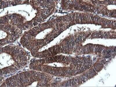 Immunohistochemistry: PI 3-Kinase C2 beta Antibody (OTI3B1) [NBP2-46402]