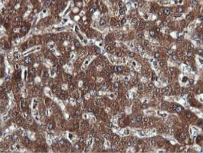 Immunohistochemistry: PI 3-Kinase C2 beta Antibody (OTI3B1) [NBP2-46402]