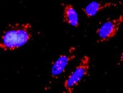 Proximity Ligation Assay: PI 3-Kinase p110 beta/PIK3CB Antibody (10D5) [H00005291-M03]
