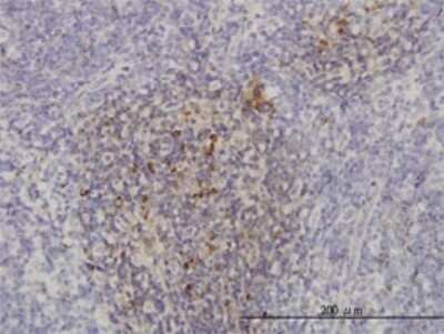 Immunohistochemistry-Paraffin: PI 3-Kinase p110 beta/PIK3CB Antibody (4H2) [H00005291-M01]
