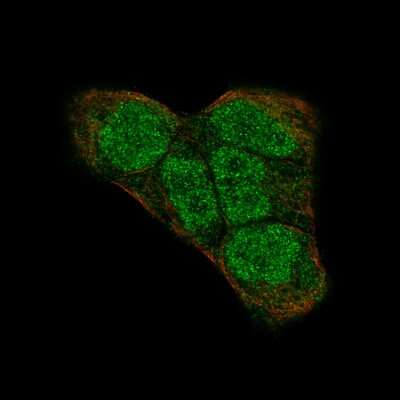 Immunocytochemistry/ Immunofluorescence: PI 3-Kinase p110 beta/PIK3CB Antibody (CL9518) [NBP2-88937]