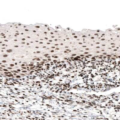 Immunohistochemistry-Paraffin: PI 3-Kinase p110 beta/PIK3CB Antibody (CL9518) [NBP2-88937]