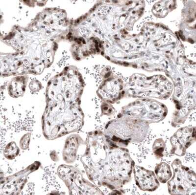 Immunohistochemistry-Paraffin: PI 3-Kinase p110 beta/PIK3CB Antibody (CL9518) [NBP2-88937]
