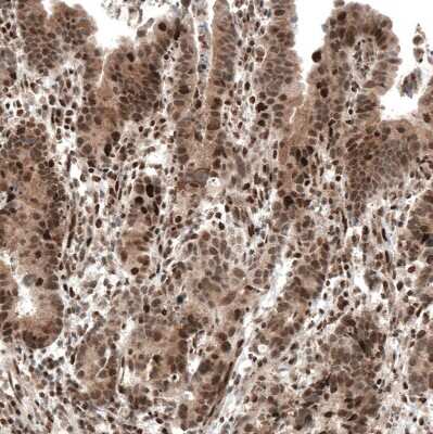 Immunohistochemistry-Paraffin: PI 3-Kinase p110 beta/PIK3CB Antibody (CL9518) [NBP2-88937]