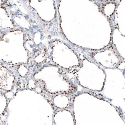 Immunohistochemistry-Paraffin: PI 3-Kinase p110 beta/PIK3CB Antibody (CL9518) [NBP2-88937]