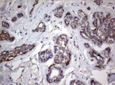 Immunohistochemistry: PI 3-Kinase p110 delta Antibody (OTI1D11) [NBP2-46404]