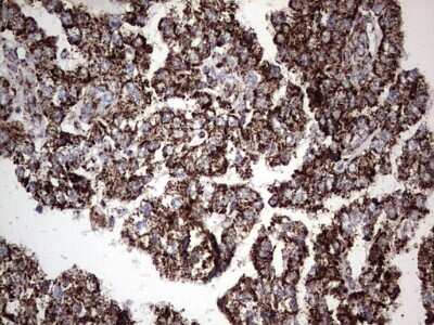 Immunohistochemistry: PI 3-Kinase p110 delta Antibody (OTI1D11) [NBP2-46404]