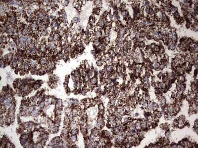 Immunohistochemistry: PI 3-Kinase p110 delta Antibody (OTI1D11) [NBP2-46404]
