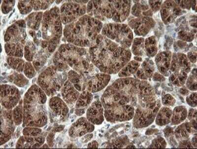 Immunohistochemistry: PI 3-Kinase p110 gamma Antibody (OTI2B1) [NBP2-46411]