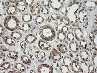 Immunohistochemistry: PI 3-Kinase p110 gamma Antibody (OTI2B1) [NBP2-46411]