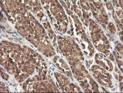 Immunohistochemistry: PI 3-Kinase p110 gamma Antibody (OTI2B1) [NBP2-46411]