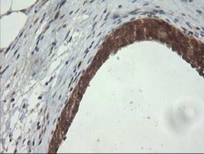 Immunohistochemistry: PI 3-Kinase p110 gamma Antibody (OTI2B1) [NBP2-46411]