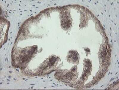 Immunohistochemistry: PI 3-Kinase p110 gamma Antibody (OTI2B1) [NBP2-46411]