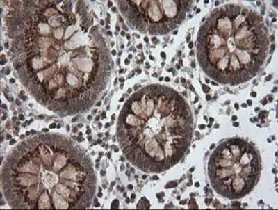 Immunohistochemistry: PI 3-Kinase p110 gamma Antibody (OTI2B1) [NBP2-46411]