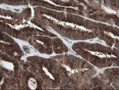 Immunohistochemistry: PI 3-Kinase p110 gamma Antibody (OTI2B1) [NBP2-46411]